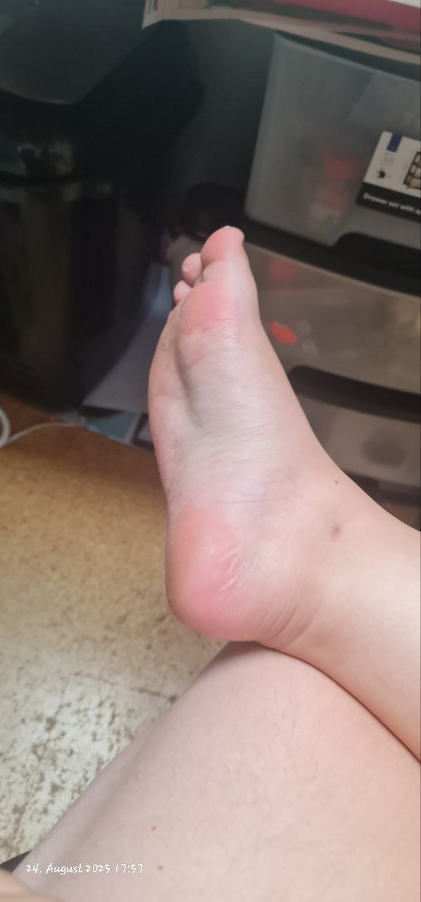 Anna-Maria Lindel, meine Hurenfüsse gehören eigentlich in hohe High-Heels #DkLUHFaj